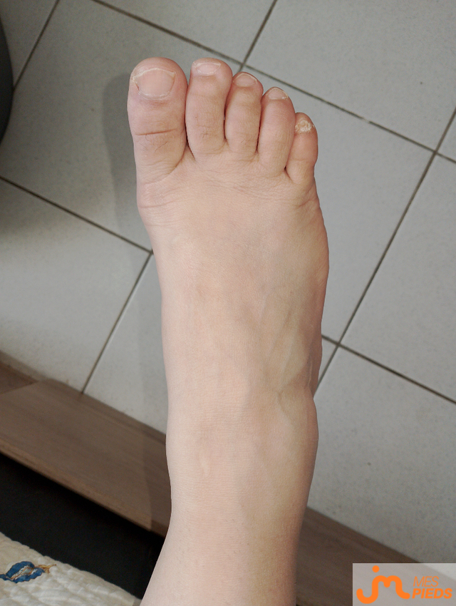 pieds de Peggy et Babe