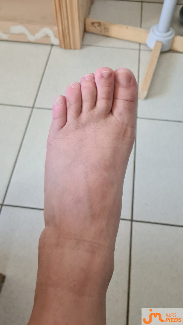 pieds de Peggy et Babe