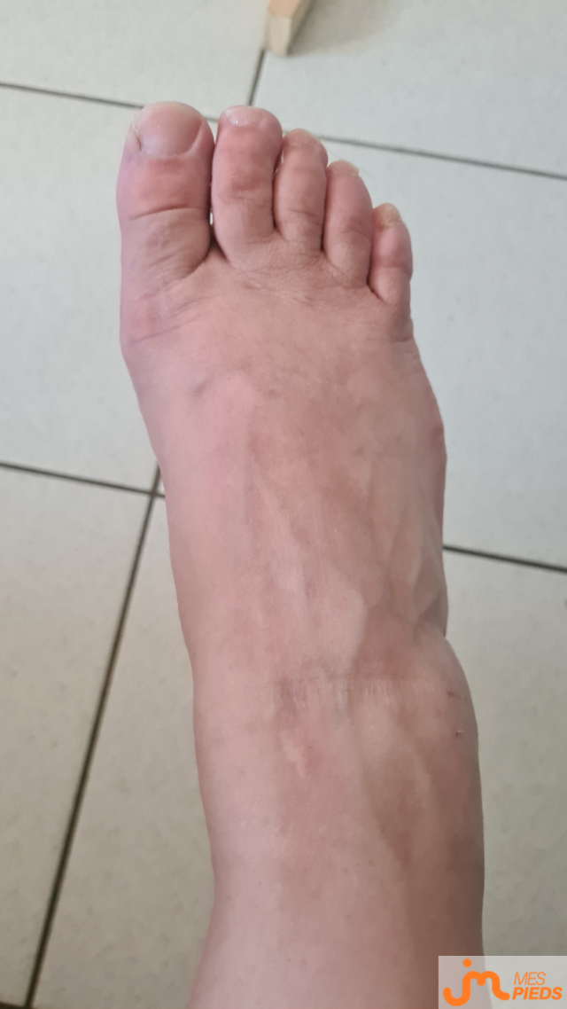 pieds de Peggy et Babe