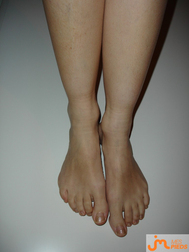 pieds de Aurore2025
