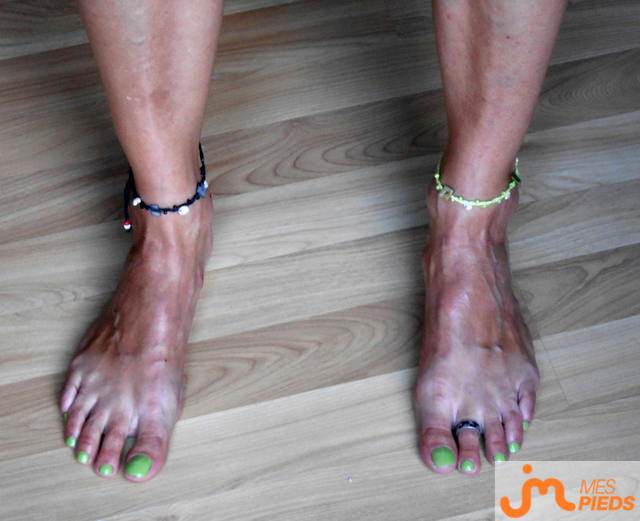 pieds de maeva66