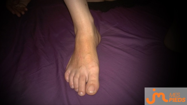 pieds de analotus
