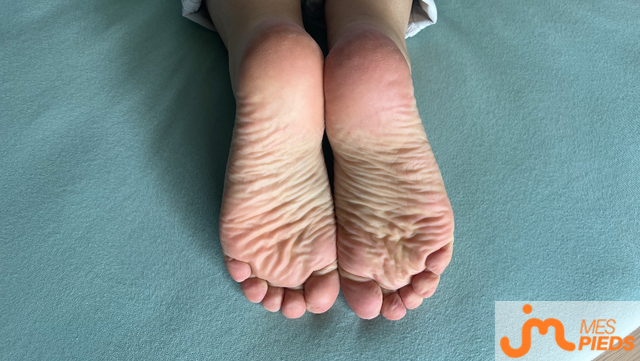 Photos de pieds : Offertes à la dégustation...