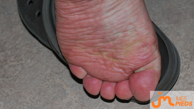 pieds de cellequejaime