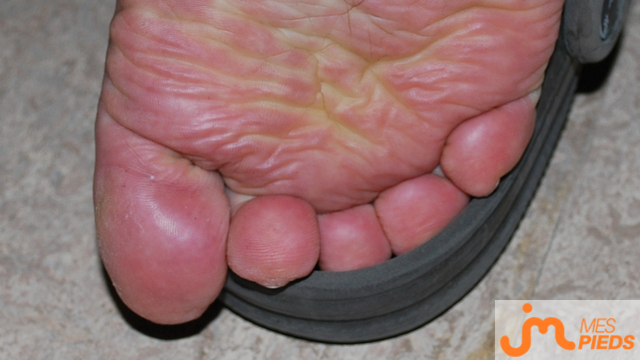 pieds de cellequejaime