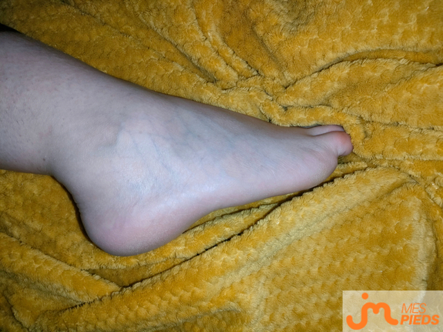 pieds de Feetmelma01 