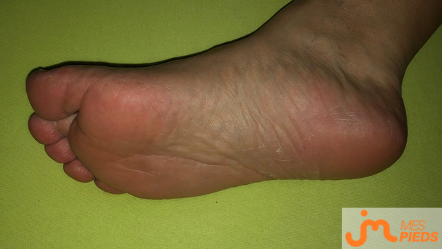 pieds de cellequejaime