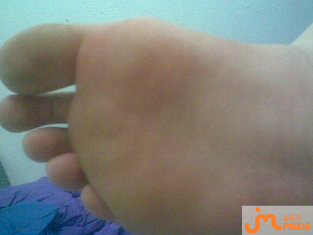 pieds de Pattoula