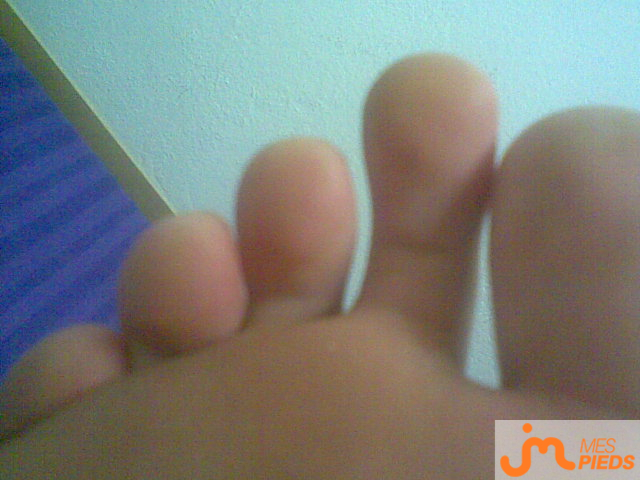 pieds de Pattoula