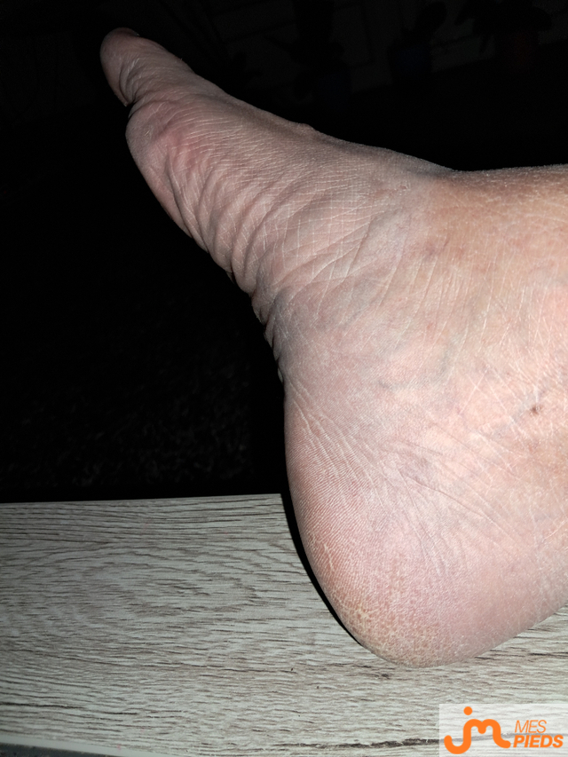 pieds de Jean eure2714