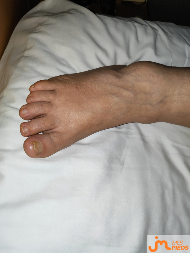 Photos de pieds : &Ccedil;a fesait longtemps , trop longtemps 