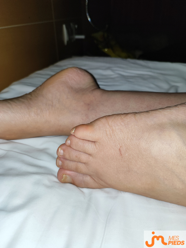 pieds de Moi18cm