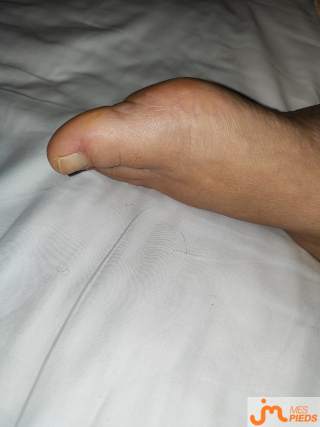 pieds de Moi18cm