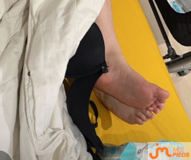 pieds de Feet039