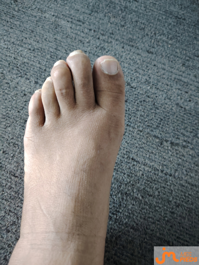 Photos de pieds : Mes pieds