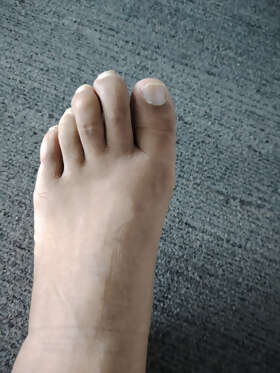 Photos de pieds : Mes pieds