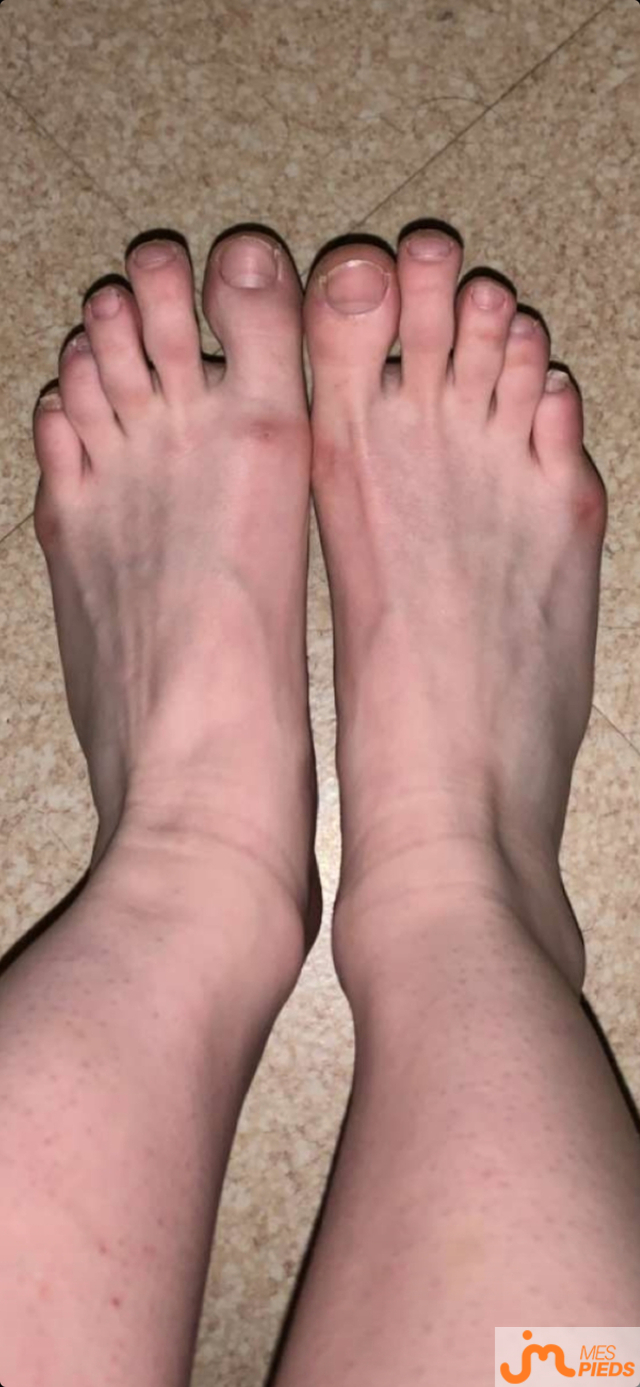 pieds de Ylou24