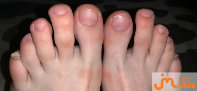 pieds de Ylou24