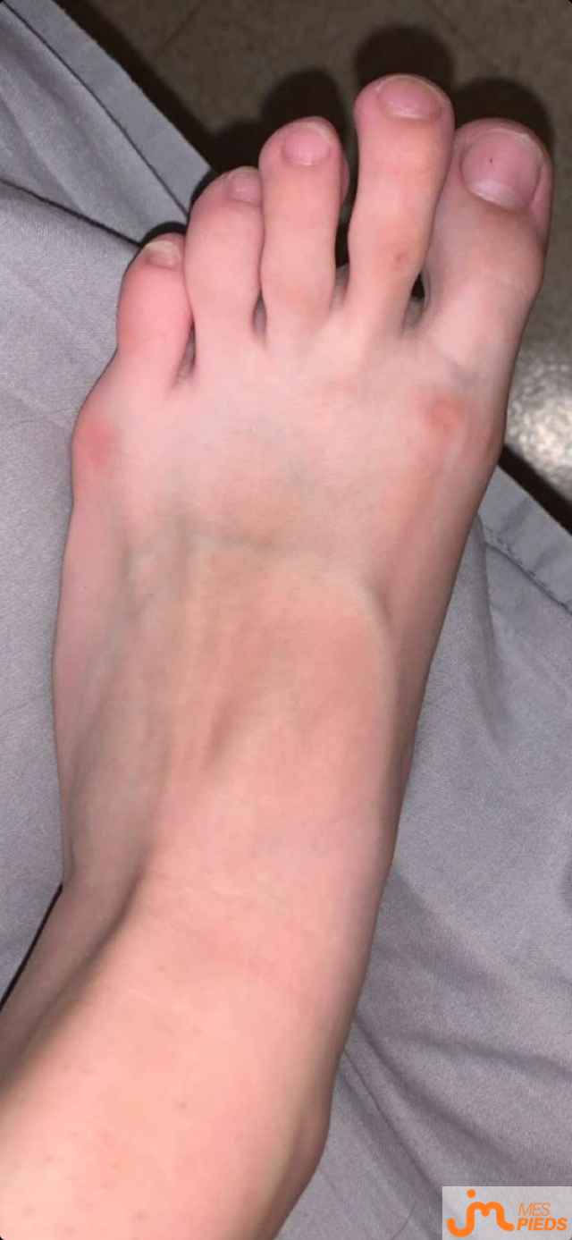 pieds de Ylou24