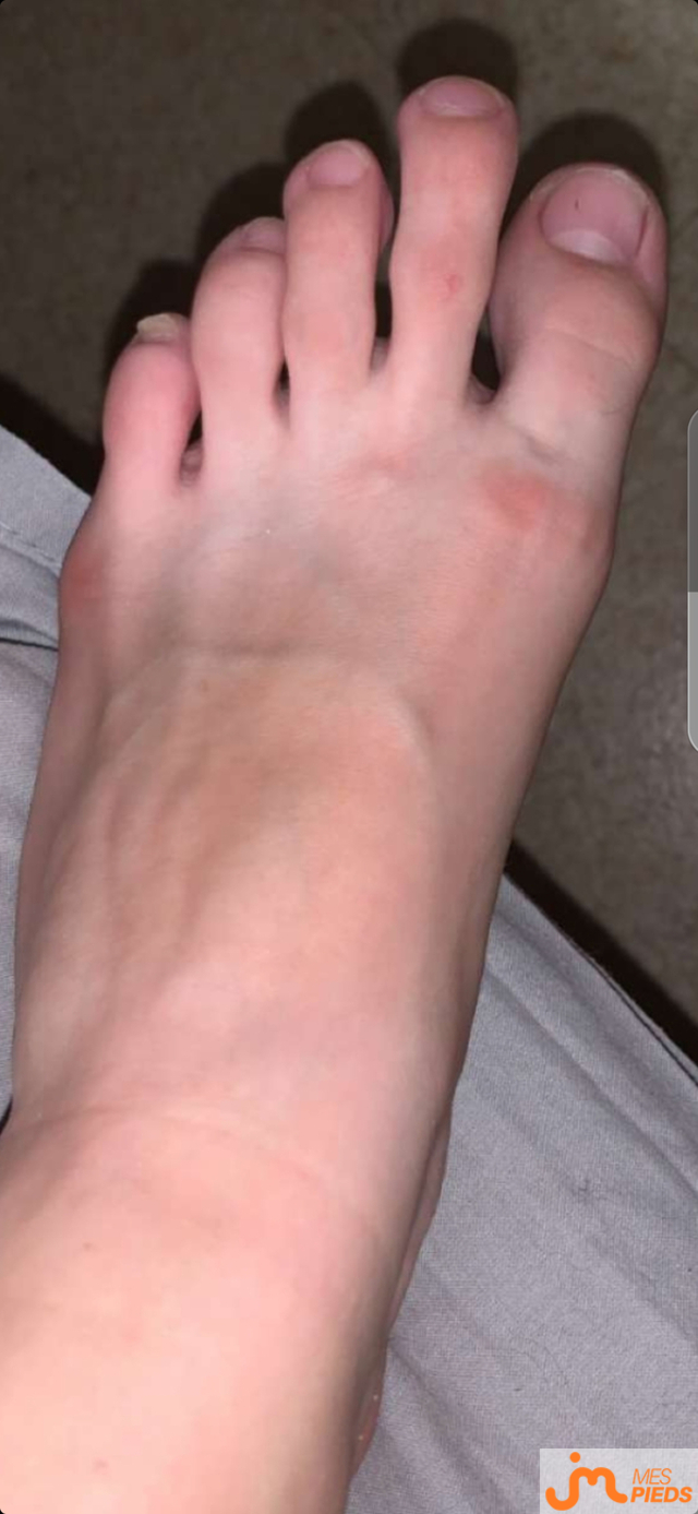 pieds de Ylou24