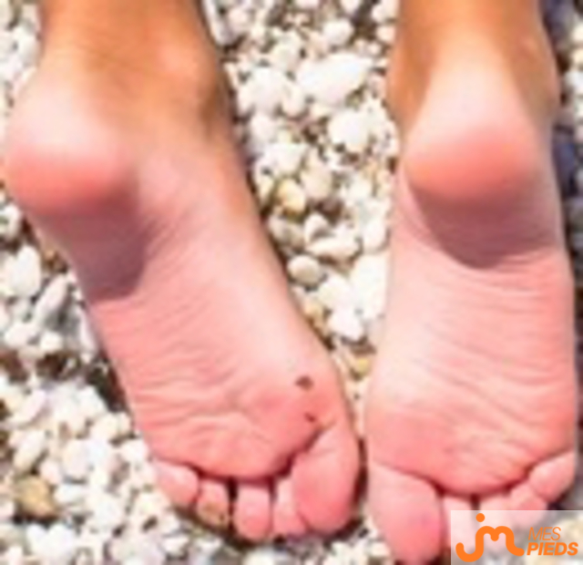 pieds de MS12