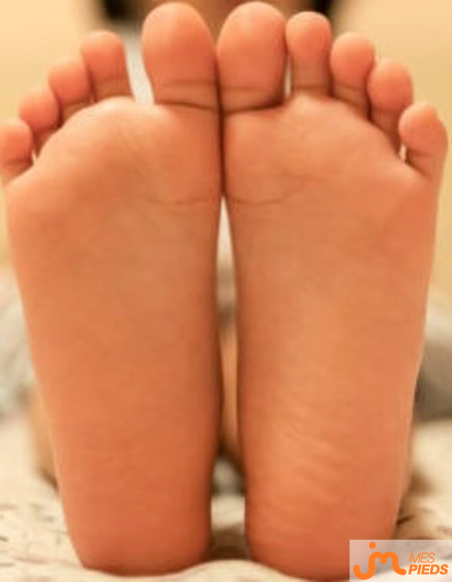 pieds de MS12