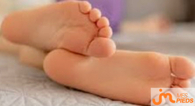 pieds de MS12