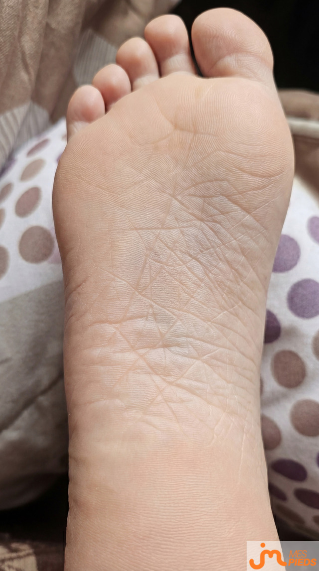 pieds de levrette