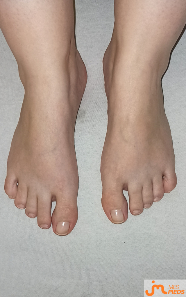 pieds de Lestitspieds