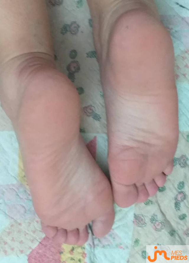 pieds de Unebiteuncul