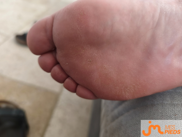 pieds de L&eacute;a2a