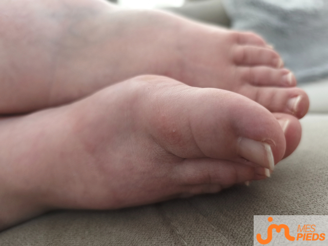 pieds de L&eacute;a2a
