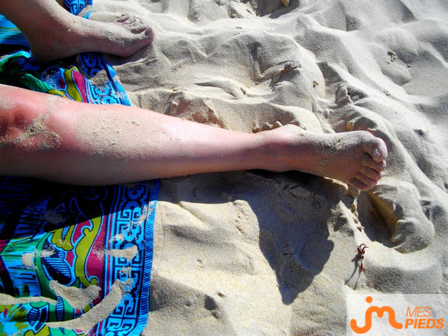 pieds de Bololos