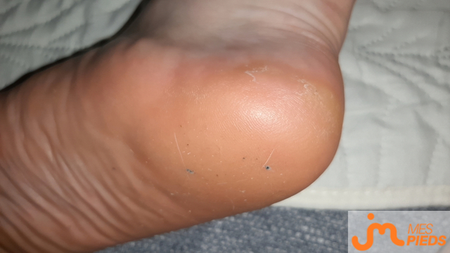 pieds de Ylou24