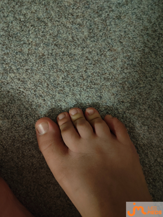 pieds de Donobitte