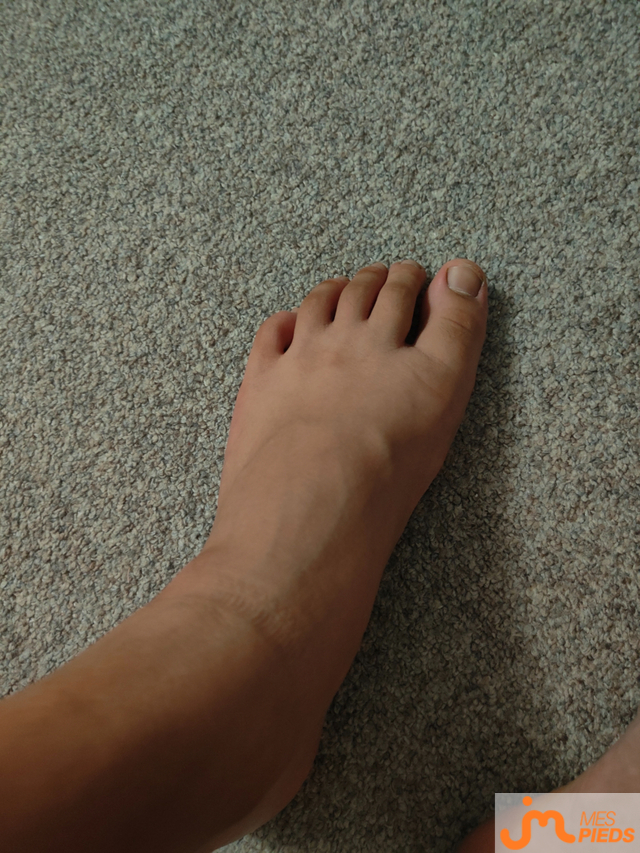 pieds de Donobitte