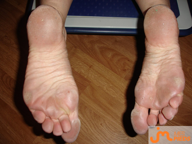 pieds de Aurore2025