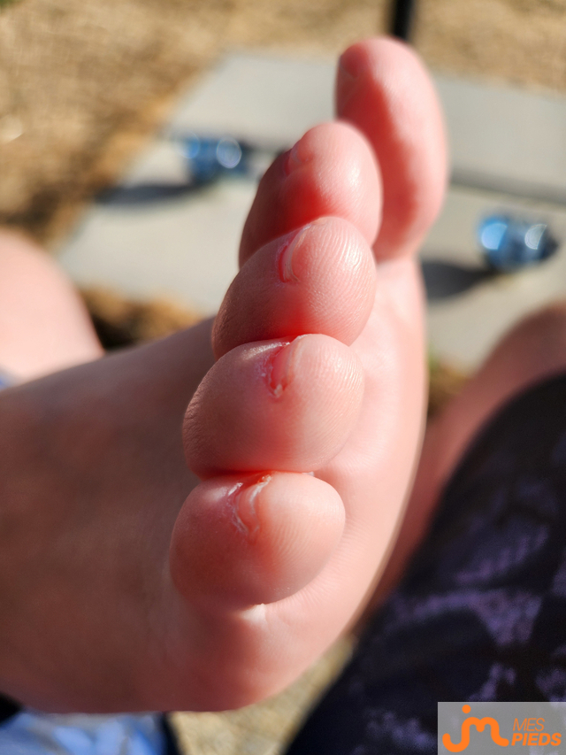 pieds de Fred21