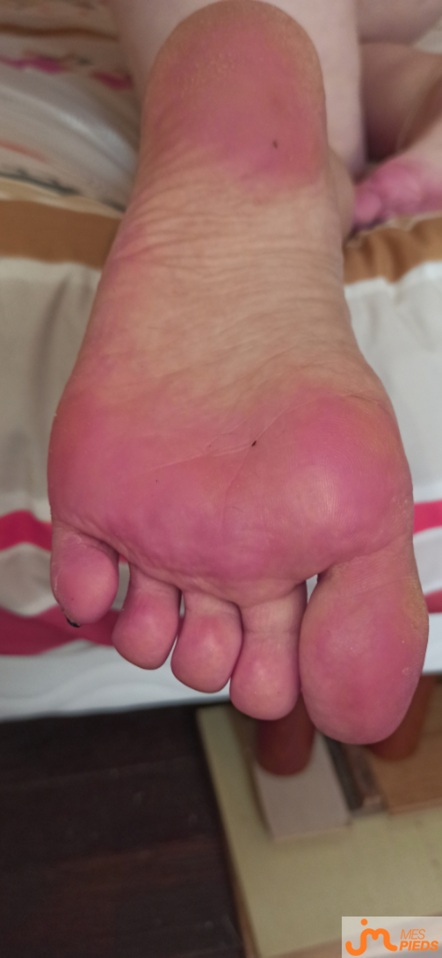 pieds de Lestitspieds