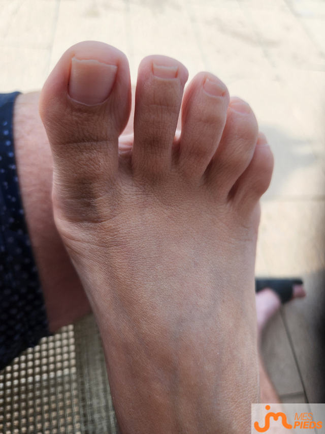 pieds de Fred21
