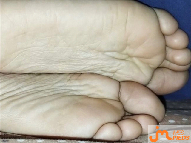 pieds de MS12