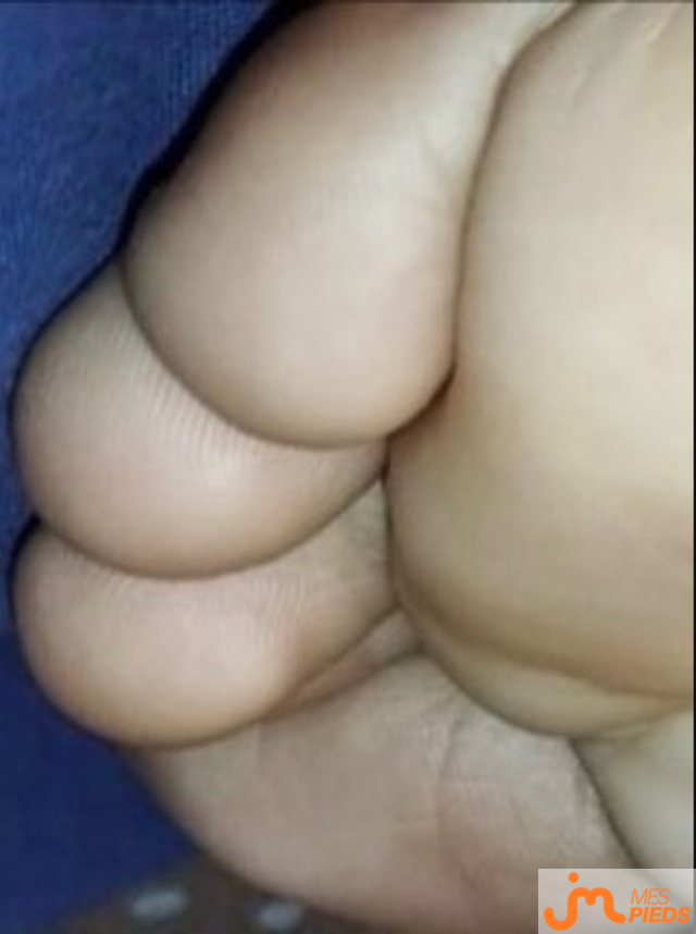 pieds de MS12