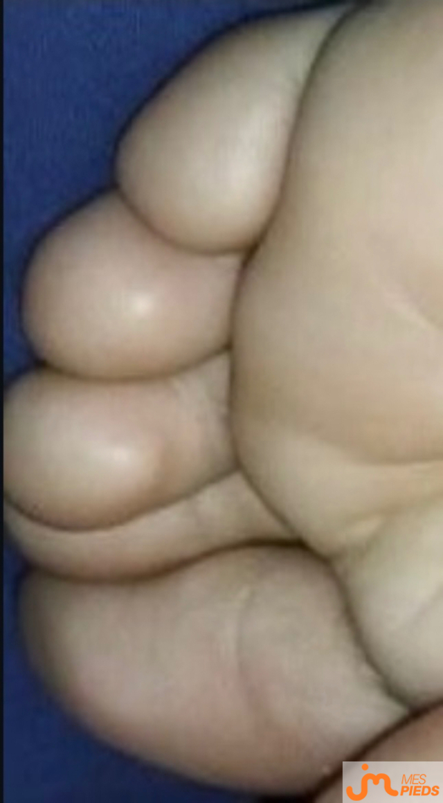 pieds de MS12