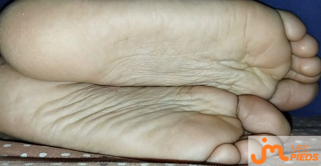pieds de MS12