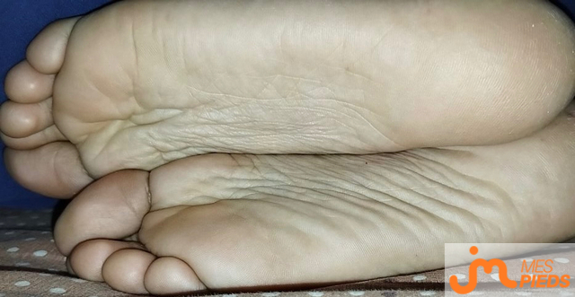 pieds de MS12