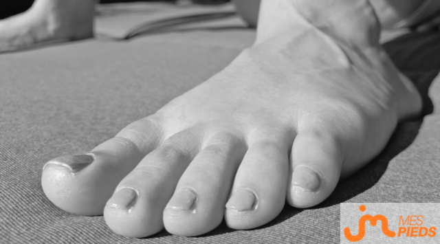 pieds de Hirondelle 
