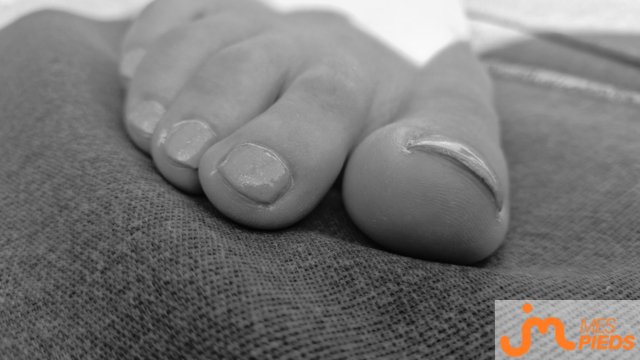 pieds de Hirondelle 