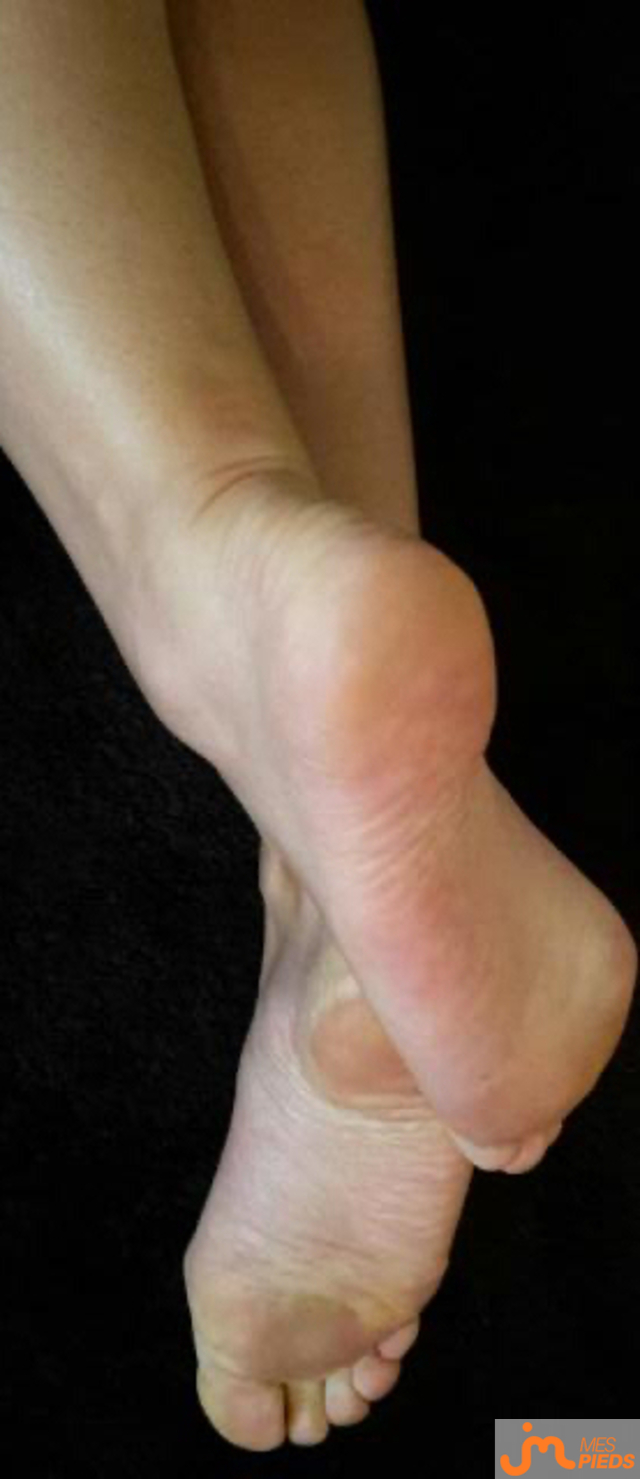 pieds de S&C44