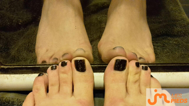 pieds de S&C44